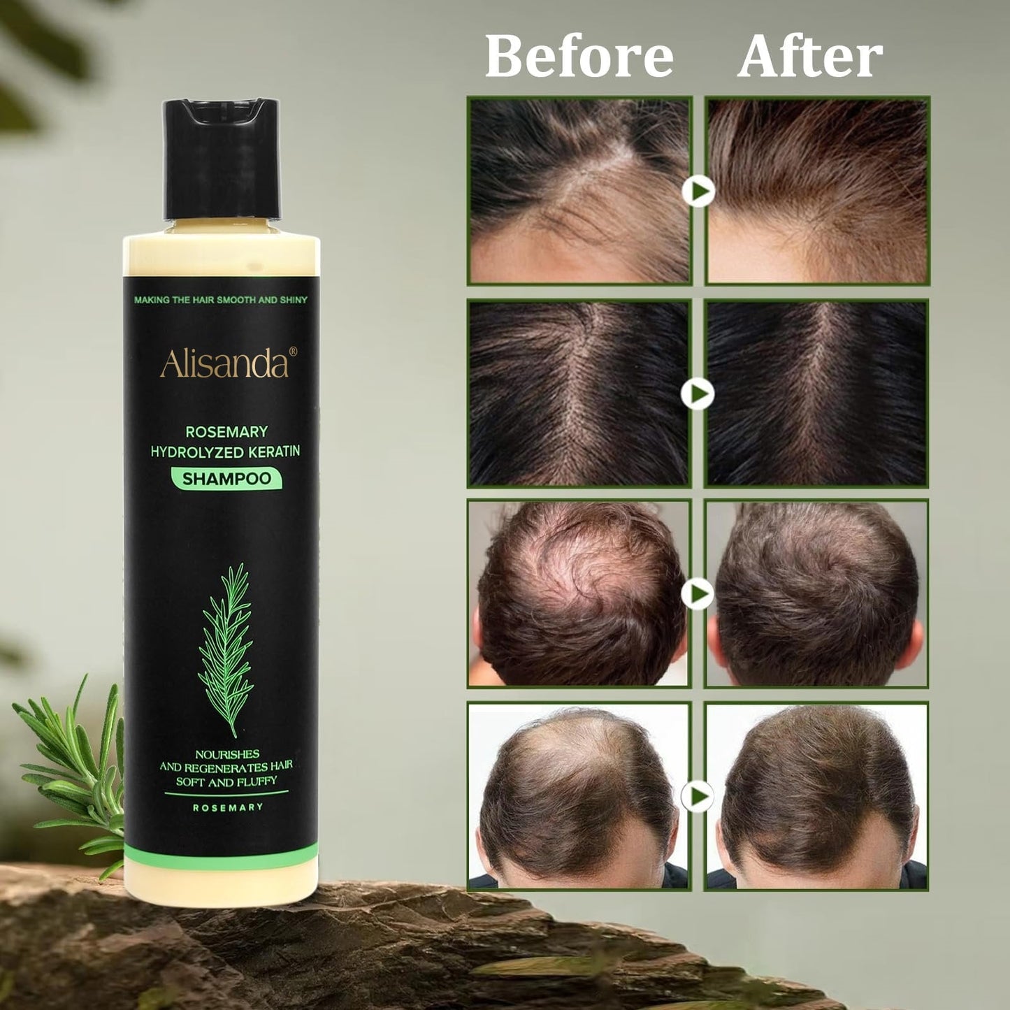 š„LAST DAY 50% OFFš„AlisandaĀ® Organic Rosemary Hair Growth Shampoo