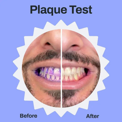 BLACK FRIDAY 50% OFF-the ultimate toothbrush for one-handed use